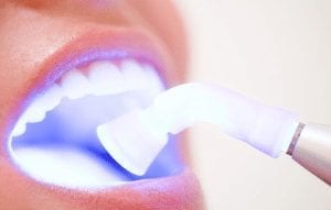 كيفية تبيض الاسنان3