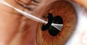 علاج جفاف العين