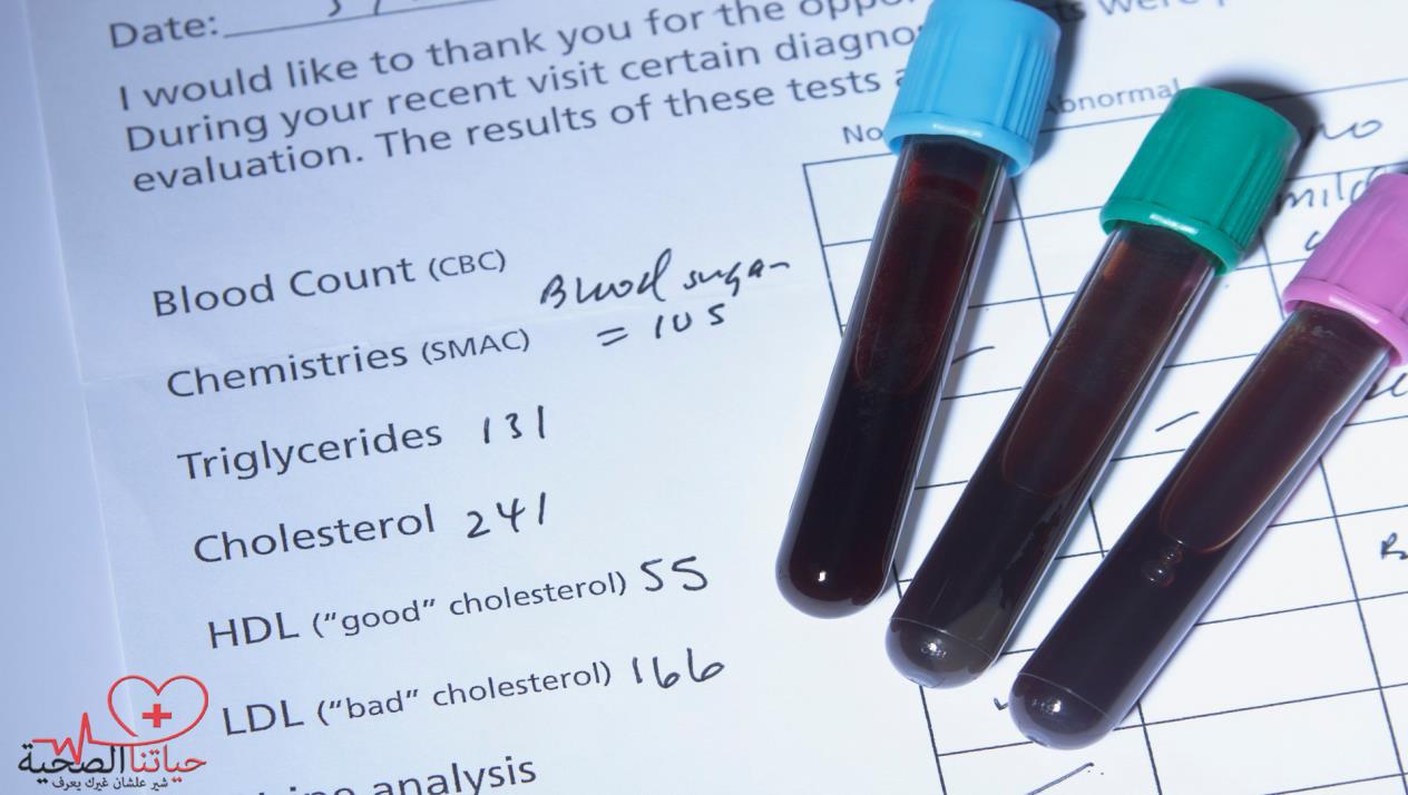 تحليل و جدول نسب الكوليسترول في الدم
